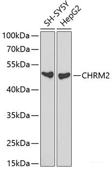 Immunofluorescence analysis of C6 cells using METTL16 Polyclonal Antibody at dilution of 1:100. Blue: DAPI for nuclear staining.