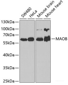 Immunofluorescence analysis of U-2 OS cells using PPIL4 Polyclonal Antibody at dilution of 1:100. Blue: DAPI for nuclear staining.