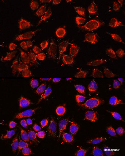 Immunohistochemistry of paraffin-embedded Human colon carcinoma using GPX2 Polyclonal Antibody at dilution of 1:100 (40x lens).