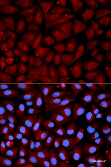 Western blot analysis of extracts of MDA-MB-435 cells using HAMP Polyclonal Antibody.