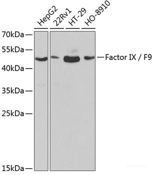 Immunofluorescence analysis of L929 cells using PTK2B Polyclonal Antibody at dilution of 1:100. Blue: DAPI for nuclear staining.