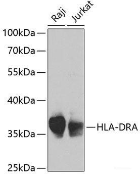 Western blot analysis of extracts of various cell lines using MMP13 Polyclonal Antibody at dilution of 1:1000.