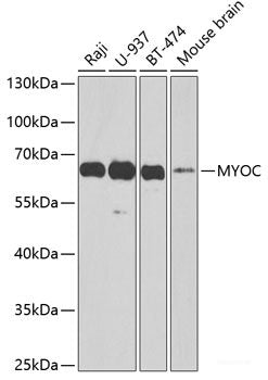 Western blot analysis of extracts of various cell lines using WBSCR27 Polyclonal Antibody at dilution of 1:1000.