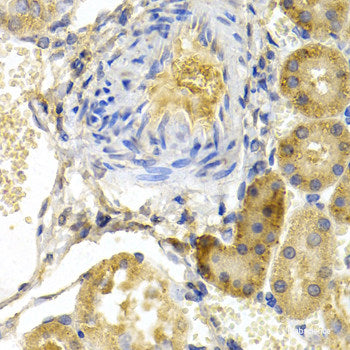 Immunohistochemistry of paraffin-embedded Mouse kidney using AQP2 Polyclonal Antibody at dilution of 1:100 (40x lens).