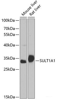 Western blot analysis of extracts of Mouse liver using GSTA1 Polyclonal Antibody at dilution of 1:1000.