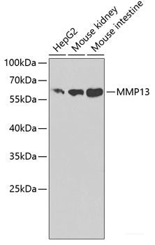 Immunohistochemistry of paraffin-embedded Rat kidney using FGD1 Polyclonal Antibody at dilution of 1:100 (40x lens).