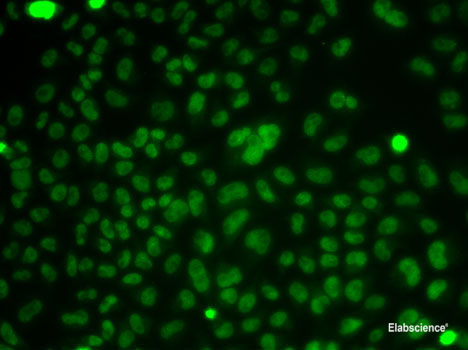 Immunohistochemistry of paraffin-embedded Rat ovary using TIMP2 Polyclonal Antibody at dilution of 1:100 (40x lens).