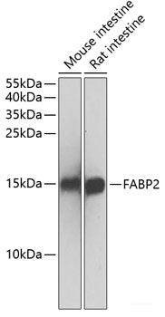 Immunofluorescence analysis of C6 cells using COMMD5 Polyclonal Antibody at dilution of 1:100. Blue: DAPI for nuclear staining.
