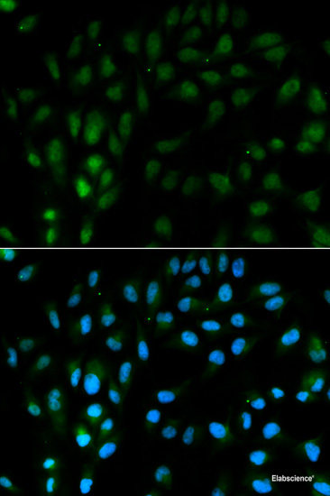 Immunohistochemistry of paraffin-embedded Rat brain using PTHLH Polyclonal Antibody at dilution of 1:200 (40x lens).