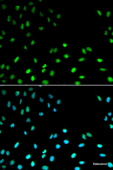 Western blot analysis of extracts of Mouse brain using CRTAC1 Polyclonal Antibody at dilution of 1:1000.