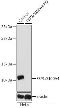 Western blot analysis of extracts of U-251MG cells using DPP10 Polyclonal Antibody at dilution of 1:1000.