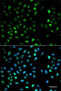 Western blot analysis of extracts of HepG2 cells using ELOVL5 Polyclonal Antibody at dilution of 1:1000.