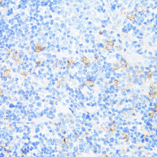 Immunofluorescence analysis of HepG2 cells (upper left) and LO2 cells (negative sample control) (upper right) using AFP Polyclonal Antibody at dilution of 1:100. Blue: DAPI for nuclear staining.