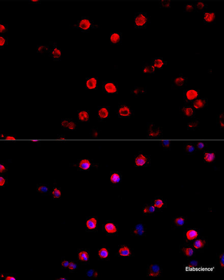 Immunohistochemistry of paraffin-embedded Rat liver using ASGR1 Polyclonal Antibody at dilution of 1:100 (40x lens).