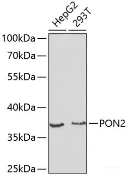 Western blot analysis of extracts of various cell lines using BMPR2 Polyclonal Antibody at dilution of 1:1000.