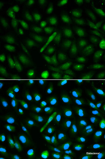 Western blot analysis of extracts of various cell lines using CAST Polyclonal Antibody at dilution of 1:1000.