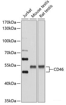 Immunohistochemistry of paraffin-embedded Human mammary cancer using FXN Polyclonal Antibody at dilution of 1:100 (40x lens).
