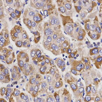 Immunofluorescence analysis of C6 cells using P70 S6K Polyclonal Antibody at dilution of 1:100. Blue: DAPI for nuclear staining.