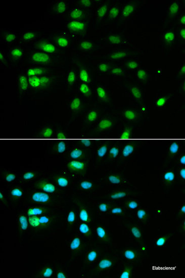 Immunohistochemistry of paraffin-embedded Human stomach using ARPC1A Polyclonal Antibody at dilution of 1:100 (40x lens).
