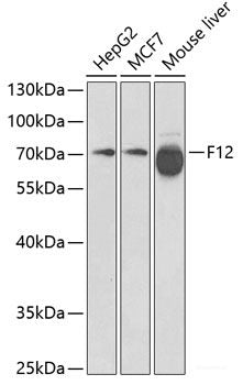 Western blot analysis of extracts of various cell lines using SLC26A11 Polyclonal Antibody at dilution of 1:1000.