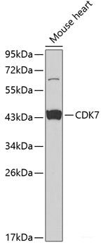Immunohistochemistry of paraffin-embedded Human stomach using HDAC6 Polyclonal Antibody at dilution of 1:100 (40x lens).