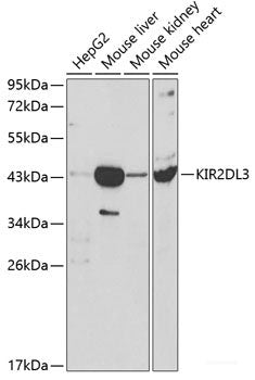 Western blot analysis of extracts of various cell lines using KPNA1 Polyclonal Antibody at dilution of 1:1000.
