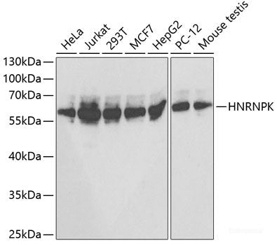 Western blot analysis of extracts of various cell lines using IFNAR2 Polyclonal Antibody at dilution of 1:1000.