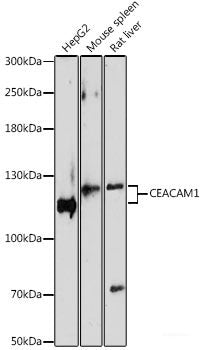 Western blot analysis of extracts of various cell lines using APOC2 Polyclonal Antibody.
