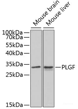Western blot analysis of extracts of various cell lines using AMBP Polyclonal Antibody at dilution of 1:1000.