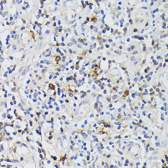 Immunofluorescence analysis of HeLa cells using ACADM Polyclonal Antibody at dilution of 1:100 (40x lens). Blue: DAPI for nuclear staining.