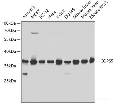 Immunohistochemistry of paraffin-embedded Rat lung using IL9 Polyclonal Antibody at dilution of 1:200 (40x lens).