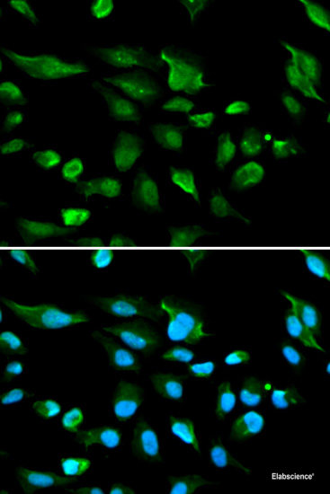 Western blot analysis of extracts of various cell lines using PDHA1 Polyclonal Antibody at dilution of 1:1000.