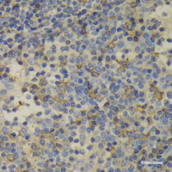 Immunohistochemistry of paraffin-embedded Human liver using CCL21 Polyclonal Antibody at dilution of 1:100 (40x lens).