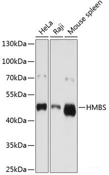 Immunohistochemistry of paraffin-embedded Rat brain using PPP2R4 Polyclonal Antibody at dilution of 1:200 (40x lens).