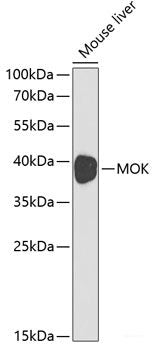 Western blot analysis of extracts of Human serum using PPBP Polyclonal Antibody at dilution of 1:1000.