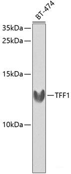 Western blot analysis of extracts of Mouse skeletal muscle using CD151 Polyclonal Antibody at dilution of 1:1000.