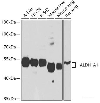 Immunohistochemistry of paraffin-embedded Human colon carcinoma using APBB1 Polyclonal Antibody at dilution of 1:100 (40x lens).