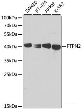 Immunohistochemistry of paraffin-embedded Human lung using SMAD5 Polyclonal Antibody at dilution of 1:100 (40x lens).