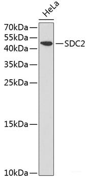 Immunohistochemistry of paraffin-embedded Rat brain using PSMD10 Polyclonal Antibody at dilution of 1:100 (40x lens).