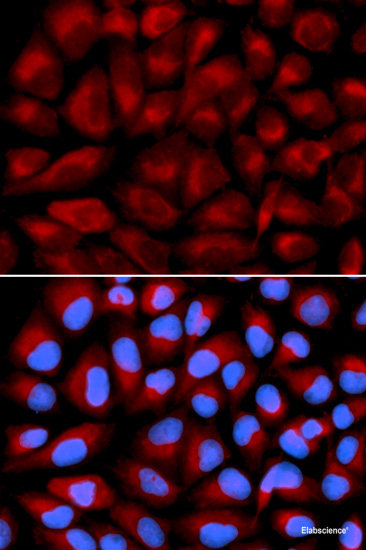 Western blot analysis of extracts of THP-1 cells using SH3KBP1 Polyclonal Antibody at dilution of 1:1000.