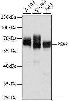 Western blot analysis of extracts of Raji cells using HVEM/TNFRSF14 Polyclonal Antibody at dilution of 1:1000.