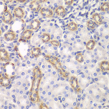 Immunohistochemistry of paraffin-embedded Human liver using CSH1 Polyclonal Antibody at dilution of 1:100 (40x lens).