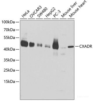 Western blot analysis of extracts of HepG2 cells using KCNN4 Polyclonal Antibody at dilution of 1:1000.