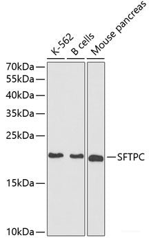 Immunohistochemistry of paraffin-embedded Human tonsil using BMPR1B Polyclonal Antibody at dilution of 1:200 (40x lens).