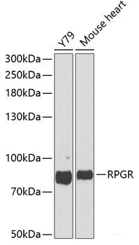 Western blot analysis of extracts of various cell lines using ANGPTL4 Polyclonal Antibody at dilution of 1:1000.