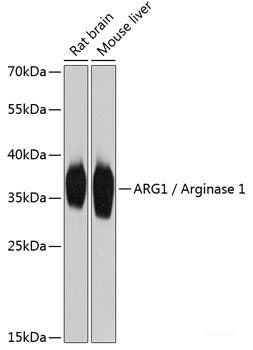 Immunohistochemistry of paraffin-embedded Human normal stomach using CHIT1 Polyclonal Antibody at dilution of 1:200 (40x lens).