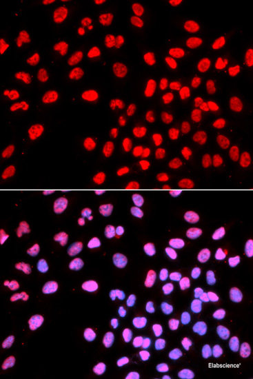 Immunofluorescence analysis of A-549 cells using TPSAB1 Polyclonal Antibody