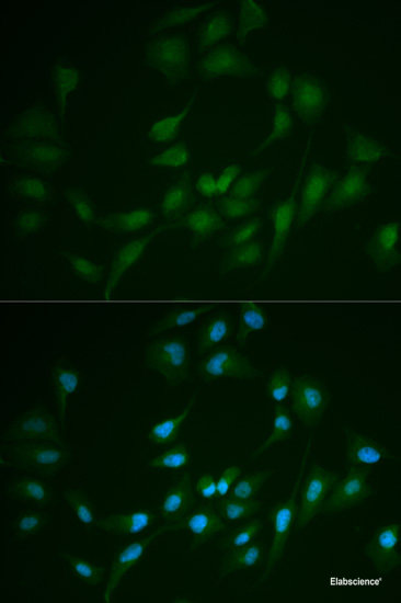 Western blot analysis of extracts of various cell lines using PRDX6 Polyclonal Antibody at dilution of 1:1000.