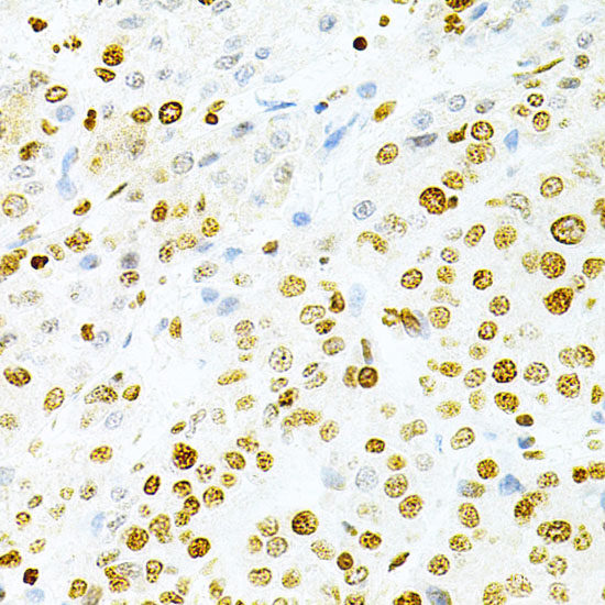 Immunohistochemistry of paraffin-embedded Rat kidney using CD83 Polyclonal Antibody at dilution of 1:200 (40x lens).