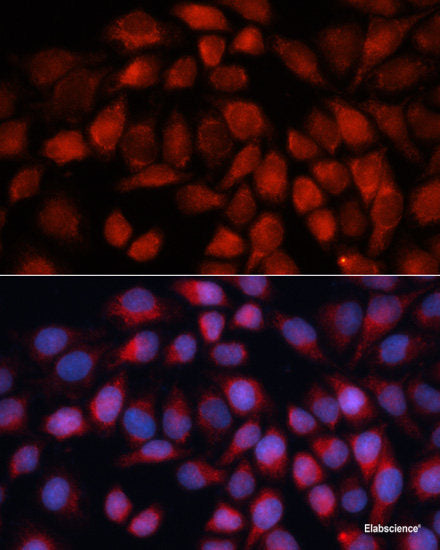 Western blot analysis of extracts of Mouse skeletal muscle using CD247 Polyclonal Antibody at dilution of 1:1000.